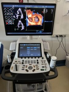 Il nuovo ecografo ad alta tecnologia all'ospedale di San Benedetto